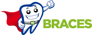 Super Braces